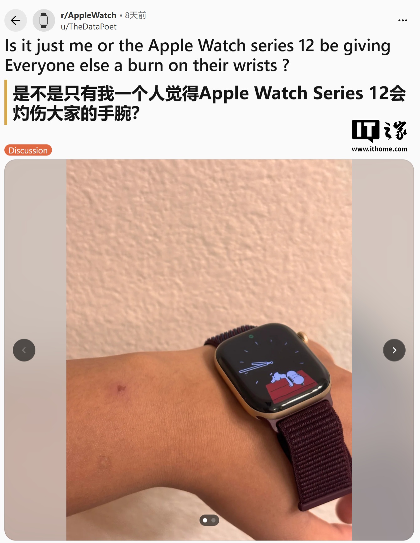 部分 Apple Watch Series 12 用户反馈传感器区发热泛红，苹果给出清洁建议